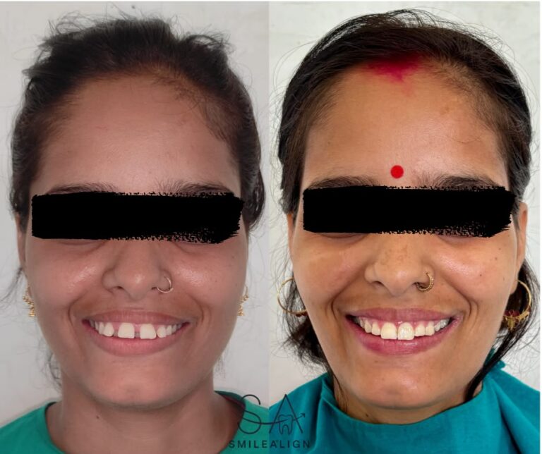 Face Transformation