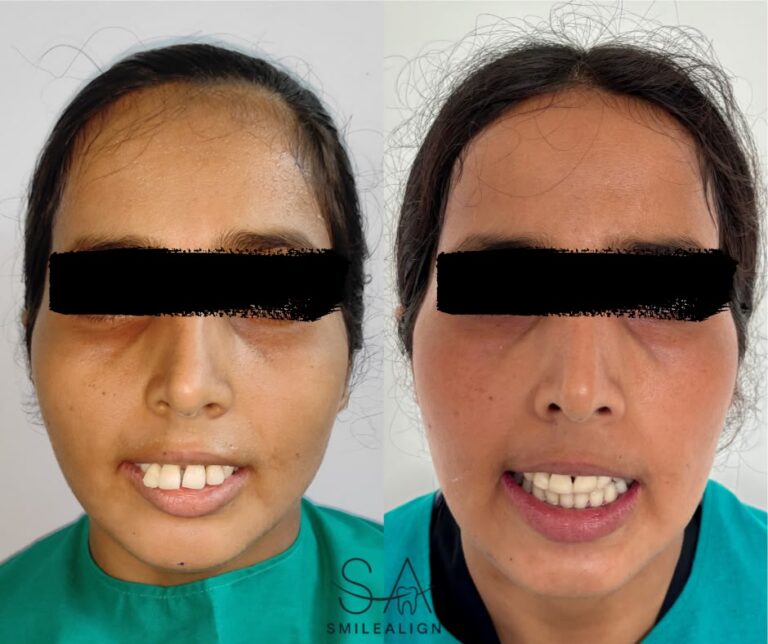 face transformation