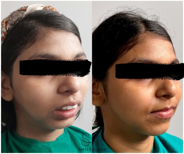 face transformation